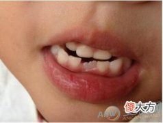 梦见牙齿长歪有着怎样的象征含义？(图文)