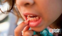 如何正确解读梦见牙齿全部掉光？(图文)