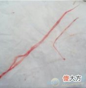 梦见血管里有虫子有着怎样的含义？(图文)