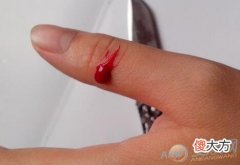 做梦梦见刀伤好不好(图文)