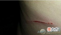 解读梦见自己肚子流血的预兆象征(图文)