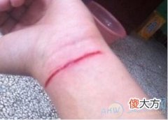 梦见手腕流血象征含义解读:与财运有关(图文)