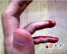 梦境解读:梦见手流血是什么意思(图文)