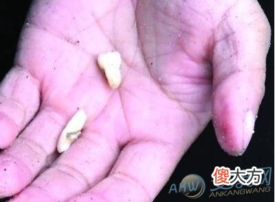 做梦梦到牙齿掉了好多(图文)