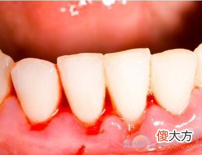 梦到牙齿流血(图文)