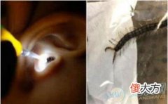 如何解析梦见虫子钻进耳朵的含义？(图文)