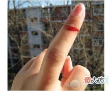 正确解读梦见中指流血的象征意义(图文)