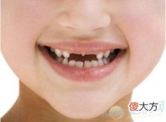 梦见自己牙齿缺了(图文)