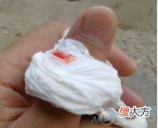 梦见被蛇咬手指的含义解析(图文)