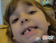 梦见自己牙齿脱落有着怎样的含义特点？(图文)