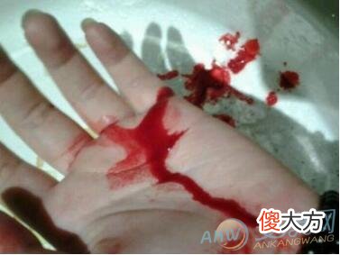 解读梦见身上沾血需要从不同角度来看(图文)