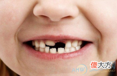 梦到自己掉牙齿 注意健康问题(图文)