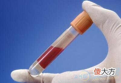 做梦梦到血(图文)