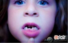 常见梦境解析-梦见断牙代表着什么？(图文)