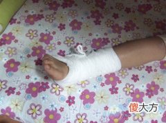 梦见脚受伤流血(图文)