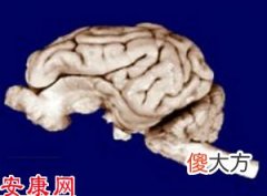 梦见脑浆(图文)