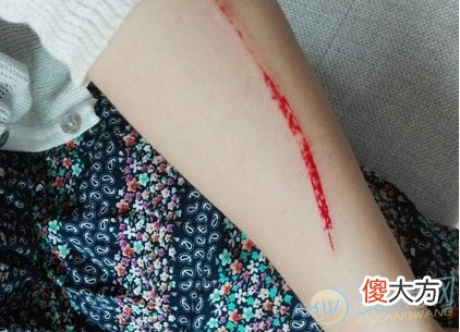 如何解读梦见手臂流血？从事物象征含义来看(图文)