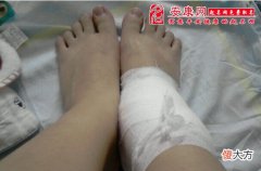 梦见妹妹脚受伤(图文)