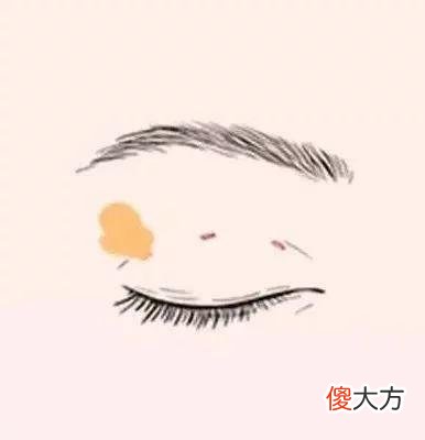 【就爱时尚】济南海峡整形分享：如何选择适合自己的双眼皮？