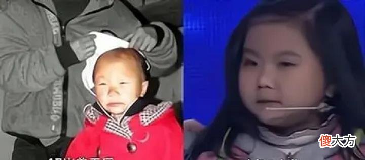 现实版返老还童？7岁衰老如老妇，17岁时重获婴儿容颜，如今？