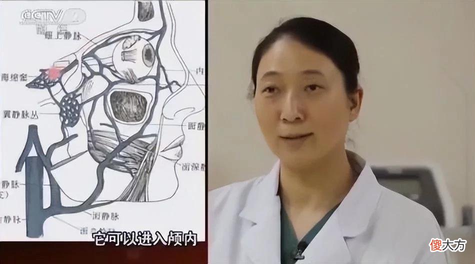 【时尚一点】女子挤痘痘脸部感染手术缝6针：是表皮样囊肿，花了一年时间才解决