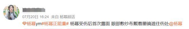 【就爱时尚】杨幂受伤了？五官位置里权值第一的是？