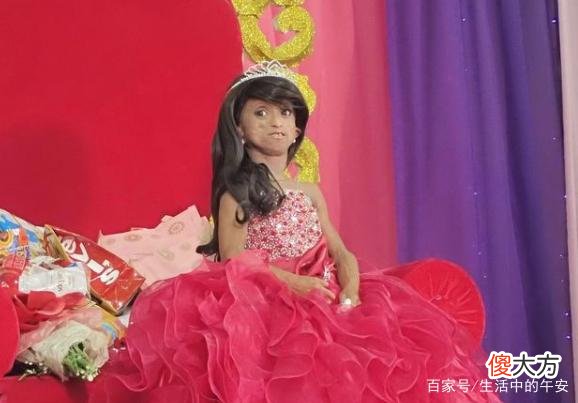 19岁菲律宾花季少女，不幸患上顽症，被人误认为是百岁老妇！