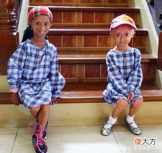 19岁菲律宾花季少女，不幸患上顽症，被人误认为是百岁老妇！