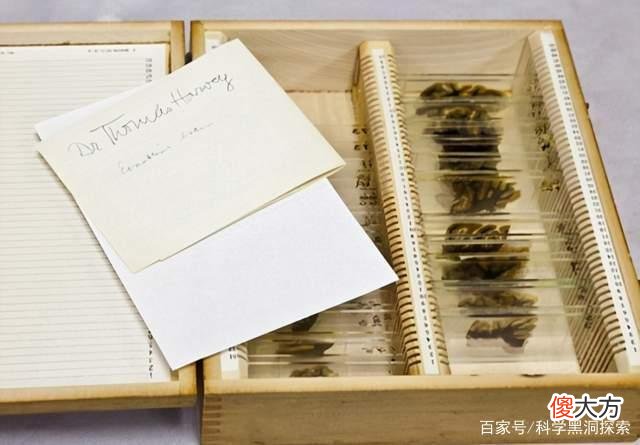 爱因斯坦去世后大脑被偷，切成240片，他的大脑有神奇之处吗？