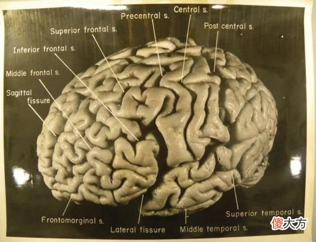 爱因斯坦临死前说了两句话，护士没懂，其大脑在死后被切成240片