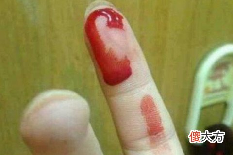 梦见手背被割伤流血