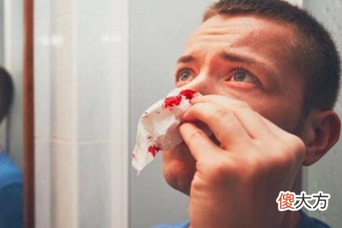 梦见自己鼻子流血