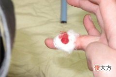 梦见自己玩刀把手划出血