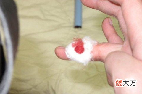 梦见自己玩刀把手划出血