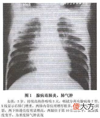 突发！140多名孩子游泳后高烧！这种病“无特效药”！重可致命！