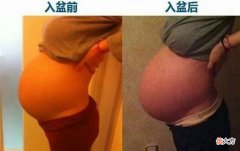 胎儿入盆孕妇有感觉吗？3个反应第一个最明显，胎儿不入盆必须剖腹产？