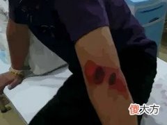 梦见肩膀受伤流血