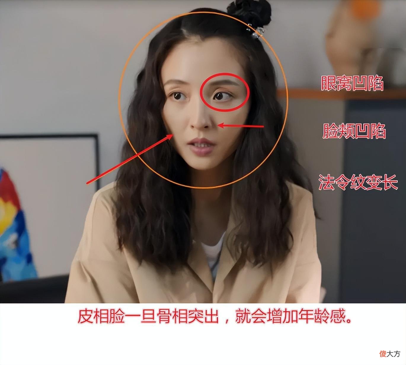 【就爱时尚】眼窝凹陷才是“毁容利器”，堪称女明星的“颜值杀手”