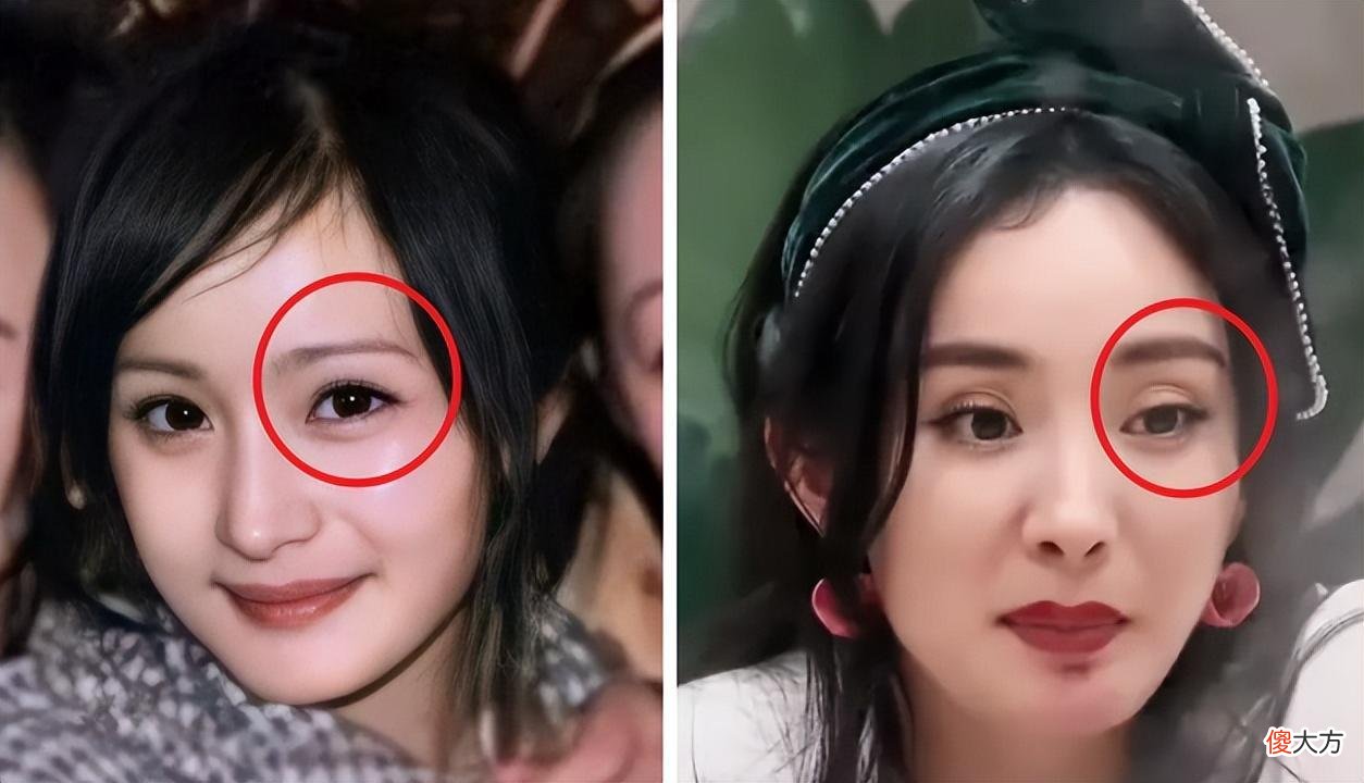 【就爱时尚】眼窝凹陷才是“毁容利器”，堪称女明星的“颜值杀手”