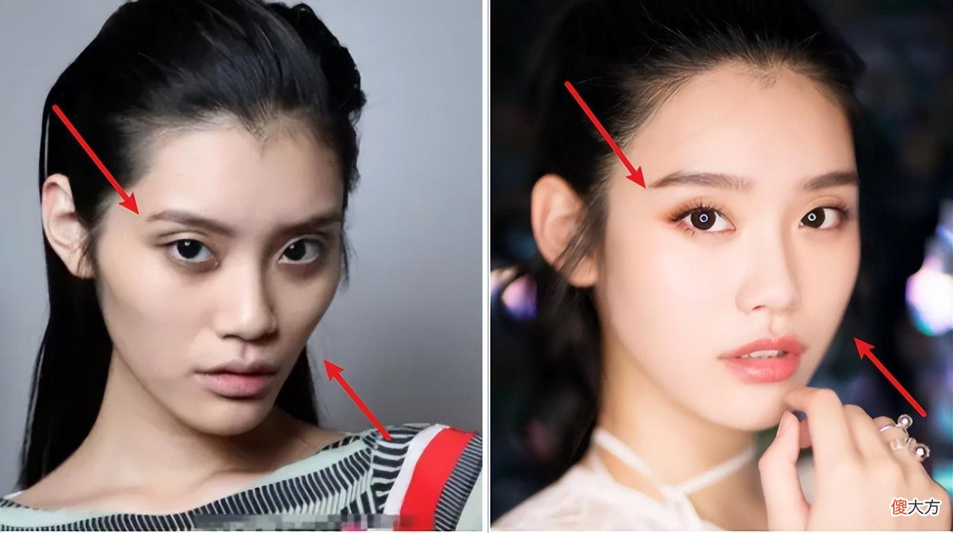 【就爱时尚】眼窝凹陷才是“毁容利器”，堪称女明星的“颜值杀手”