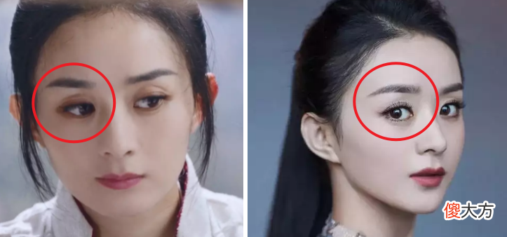 【就爱时尚】眼窝凹陷才是“毁容利器”，堪称女明星的“颜值杀手”