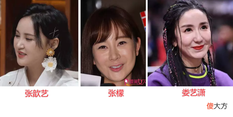 【就爱时尚】眼窝凹陷才是“毁容利器”，堪称女明星的“颜值杀手”