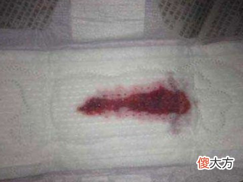 梦见床单有经血