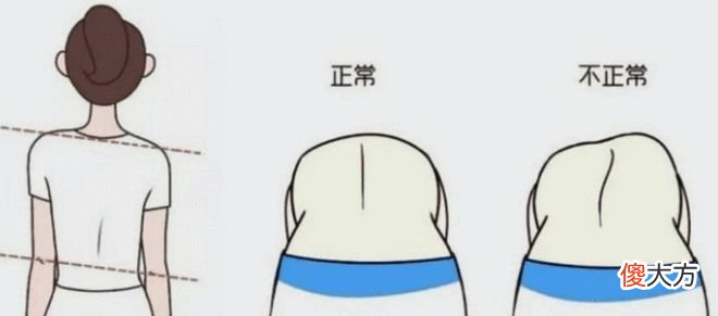 危害中国儿童健康的第三大“杀手”，脊柱健康