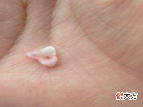 梦见牙齿碎了一小块一小块掉