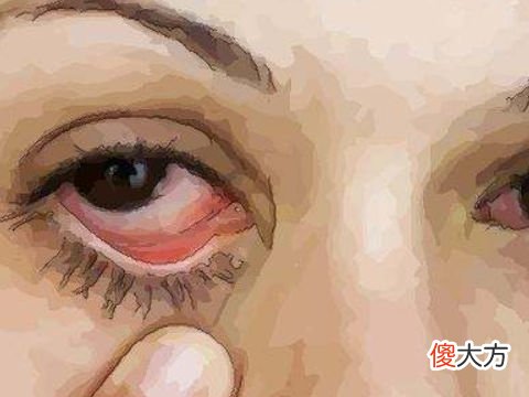 梦见一只眼睛