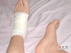 梦见断脚