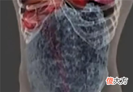 老人五脏六腑凭空消失，毫无异样活了50年，检查后医生直摇头