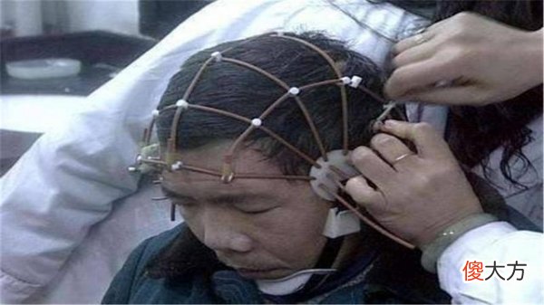 男子几十年“死亡”101次，每次都死而复生，专家揭开真相