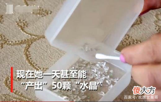 女子患怪病流水晶泪，一天可最多产出50颗，每天犹如地狱般生活